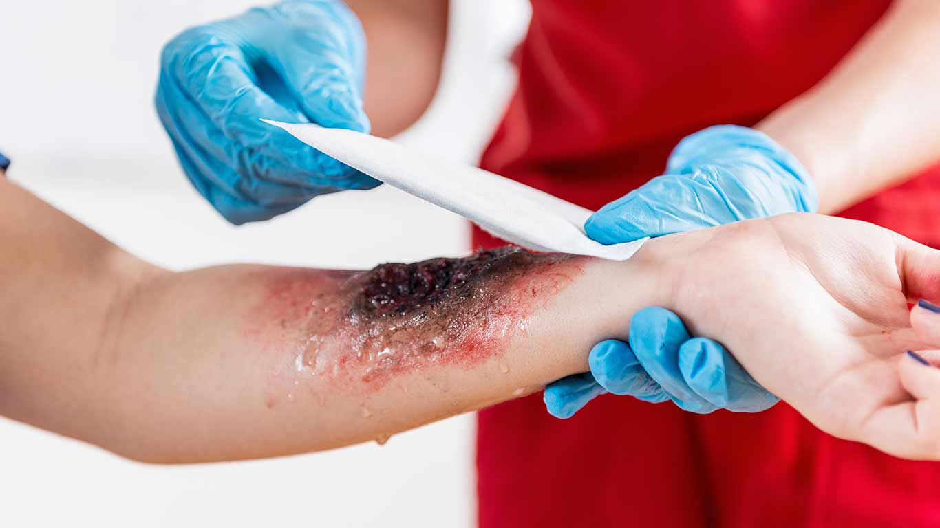 Attention to Traumatic Wounds Home Landing Page Health Factor Products 5 Guidance for Traumatic Wounds Home Landing Page Health Factor Products
