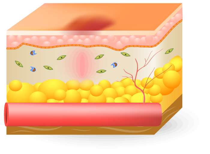 Healing Phase Home Landing Page Health Factor Products 9 Proliferative Phase of wound Home Landing Page Health Factor Products