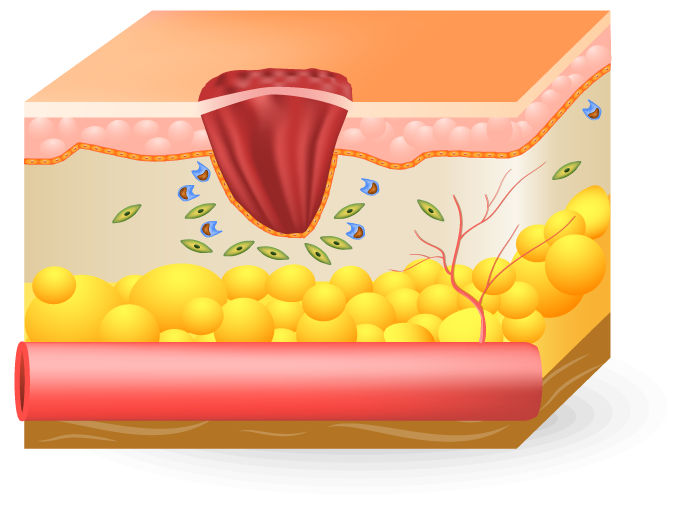 Proliferative Phase Home Landing Page Health Factor Products 8 Proliferative Phase of wound Home Landing Page Health Factor Products