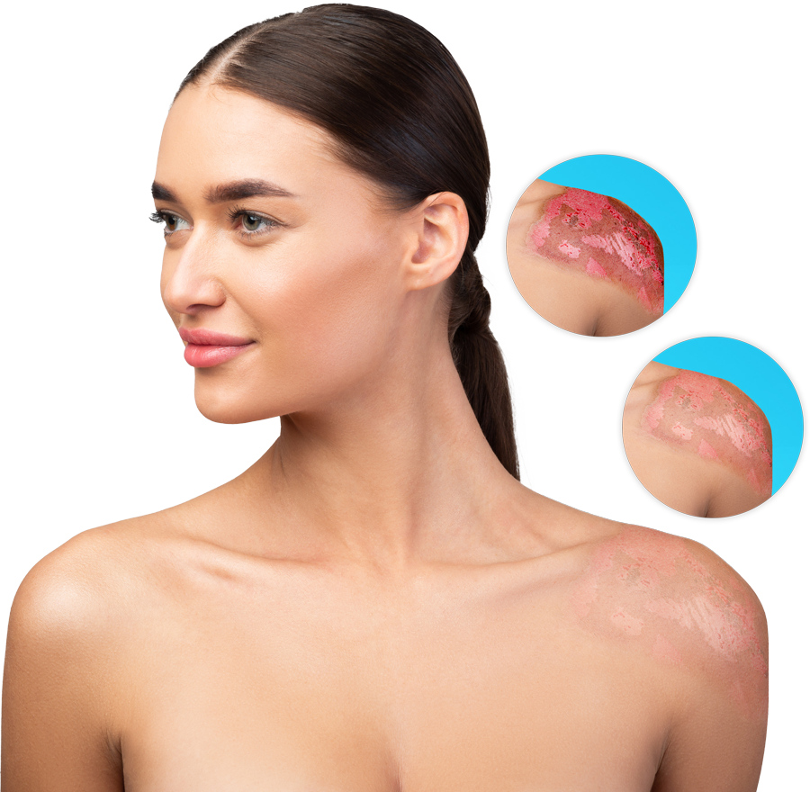 advanced wound care solution hfactor Home Landing Page Health Factor Products 3 Home Landing Page Health Factor Products